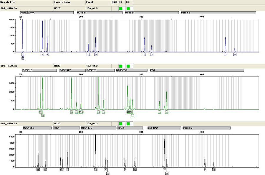 太原司法DNA亲子鉴定程序是什么,太原司法DNA鉴定哪里做
